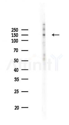 Phospho-DAPK1 (Ser734) Antibody - Western blot analysis of lysates from HUVEC cells(UV 30min treatment), using Phospho-DAPK1 (Ser734) Antibody at 1/1000 dilution.