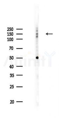 Phospho-DAPK1 (Ser289) Antibody - Western blot analysis of lysates from HUVEC cells(UV 30min treatment), using Phospho-DAPK1 (Ser289) Antibody at 1/1000 dilution.