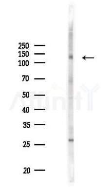 Phospho-EPHA8 (Tyr839) Antibody - Western blot analysis of lysates from HUVEC cells(UV 30min treatment), using Phospho-EPHA8 (Tyr839) Antibody at 1/1000 dilution.