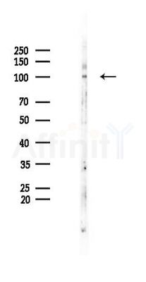 Phospho-EPHA8 (Tyr616) Antibody - Western blot analysis of lysates from B16F10-LUC cells(UV 30min treatment), using Phospho-EPHA8 (Tyr616) Antibody at 1/1000 dilution.