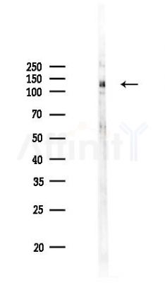 Phospho-EPHA8 (Tyr616) Antibody - Western blot analysis of lysates from HUVEC cells(UV 30min treatment), using Phospho-EPHA8 (Tyr616) Antibody at 1/1000 dilution.