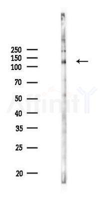 Phospho-Flt3 / CD135 (Tyr591) Antibody - Western blot analysis of lysates from HUVEC cells(UV 30min treatment), using Phospho-Flt3 / CD135 (Tyr591) Antibody at 1/1000 dilution.