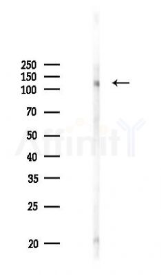 Phospho-JAK2/3 (Tyr966/Tyr939) Antibody - Western blot analysis of lysates from HUVEC cells(UV 30min treatment), using Phospho-JAK2/3 (Tyr966/Tyr939) Antibody at 1/1000 dilution.