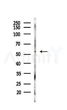 Phospho-MEK5 (Ser311) Antibody - Western blot analysis of lysates from K562 cells(LPS 4h treatment), using Phospho-MEK5 (Ser311) Antibody at 1/1000 dilution.