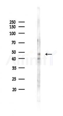 Phospho-MOK (Tyr161) Antibody - Western blot analysis of lysates from Mouse brain, using Phospho-MOK (Tyr161) Antibody at 1/1000 dilution.