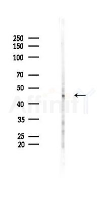 Phospho-MOK (Tyr161) Antibody - Western blot analysis of lysates from B16F10-LUC cells(UV 30min treatment), using Phospho-MOK (Tyr161) Antibody at 1/1000 dilution.
