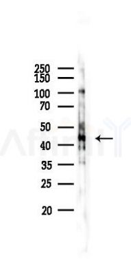 Phospho-p38 gamma/delta (Tyr185/Tyr182) Antibody - Western blot analysis of lysates from 293 cells(heat-shock 45min treatment), using Phospho-p38 gamma/delta (Tyr185/Tyr182) Antibody at 1/1000 dilution.