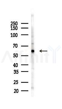 Phospho-p70 S6 Kinase (Ser427) Antibody - Western blot analysis of lysates from K562 cells(LPS 4h treatment), using Phospho-p70 S6 Kinase (Ser427) Antibody at 1/1000 dilution.
