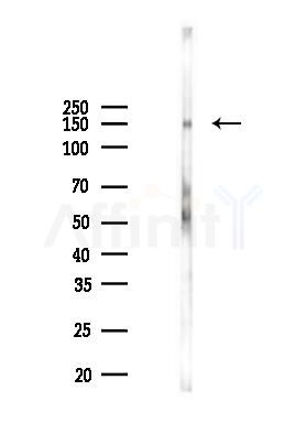 Phospho-SIK1(T182)/SIK2(T175)/SIK3(T221) Antibody - Western blot analysis of lysates from PC12 cells(starvation 24h treatment), using Phospho-SIK1(T182)/SIK2(T175)/SIK3(T221) Antibody at 1/1000 dilution.