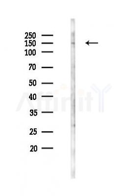 Phospho-TIE1 (Tyr1117) Antibody - Western blot analysis of lysates from COLO205 cells(heat-shock 45min treatment), using Phospho-TIE1 (Tyr1117) Antibody at 1/1000 dilution.