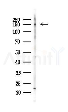 Phospho-Ret (Tyr1015) Antibody - Western blot analysis of lysates from K562 cells(LPS 4h treatment), using Phospho-Ret (Tyr1015) Antibody at 1/1000 dilution.
