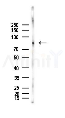 Phospho-LRP1/CD91 (Ser4520) Antibody - Western blot analysis of lysates from Mouse muscle, using Phospho-LRP1/CD91 (Ser4520) Antibody at 1/1000 dilution.