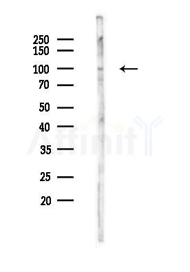 Phospho-FGFR1/2/3/4 (Tyr653+Tyr654) Antibody - Western blot analysis of lysates from HUVEC cells(heat-shock 45min treatment), using Phospho-FGFR1/2/3/4 (Tyr653+Tyr654) Antibody at 1/1000 dilution.