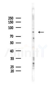 Phospho-eIF2B epsilon (Ser525) Antibody - Western blot analysis of lysates from B16F10-LUC cells(UV 30min treatment), using Phospho-eIF2B epsilon (Ser525) Antibody at 1/1000 dilution.
