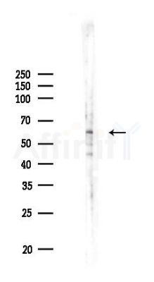 Phospho-eIF2B epsilon (Ser525) Antibody - Western blot analysis of lysates from HUVEC cells(UV 30min treatment), using Phospho-eIF2B epsilon (Ser525) Antibody at 1/1000 dilution.