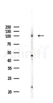 Phospho-CD22 (Tyr842) Antibody - Western blot analysis of lysates from HUVEC cells(UV 30min treatment), using Phospho-CD22 (Tyr842) Antibody at 1/1000 dilution.
