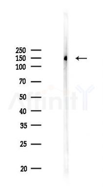 Phospho-FGFR1/2 (Tyr730/Tyr733) Antibody - Western blot analysis of lysates from HUVEC cells(UV 30min treatment), using Phospho-FGFR1/2 (Tyr730/Tyr733) Antibody at 1/1000 dilution.