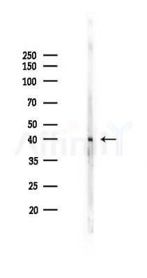 Phospho-Estrogen Receptor-beta (Ser87) Antibody - Western blot analysis of lysates from Mouse brain, using Phospho-Estrogen Receptor-beta (Ser87) Antibody at 1/1000 dilution.
