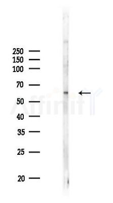 Phospho-Estrogen Receptor-beta (Ser87) Antibody - Western blot analysis of lysates from HUVEC cells(UV 30min treatment), using Phospho-Estrogen Receptor-beta (Ser87) Antibody at 1/1000 dilution.