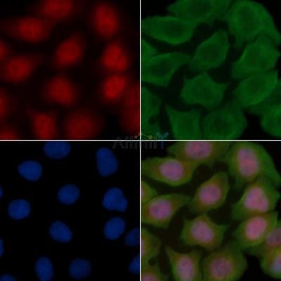Phospho-Estrogen Receptor-beta (Ser87) Antibody - AF8235 staining Hela cells(30min of UV treatment) by IF/ICC.