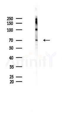 Phospho-Calpain 2 (Ser50) Antibody - Western blot analysis of lysates from B16F10-LUC cells(UV 30min treatment), using Phospho-Calpain 2 (Ser50) Antibody at 1/1000 dilution.