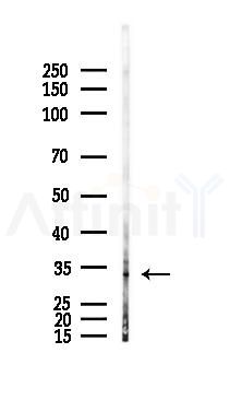 Phospho-Cyclin D1 (Thr288) Antibody - Western blot analysis of lysates from Mouse muscle, using Phospho-Cyclin D1 (Thr288) Antibody at 1/1000 dilution.