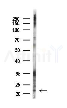 Phospho-Calcipressin 1 (Ser163) Antibody - Western blot analysis of lysates from K562 cells(LPS 4h treatment), using Phospho-Calcipressin 1 (Ser163) Antibody at 1/1000 dilution.