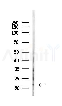 Phospho-Calcipressin 1 (Ser163) Antibody - Western blot analysis of lysates from Hela cells(UV 30min treatment), using Phospho-Calcipressin 1 (Ser163) Antibody at 1/1000 dilution.