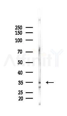 Phospho-HtrA2 (Ser212) Antibody - Western blot analysis of lysates from Rat kidney, using Phospho-HtrA2 (Ser212) Antibody at 1/1000 dilution.