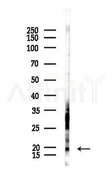 Phospho-JDP2 (Thr148) Antibody - Western blot analysis of lysates from PC12 cells(UV 30min treatment), using Phospho-JDP2 (Thr148) Antibody at 1/1000 dilution.