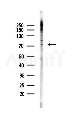 Phospho-LIMK1 (Ser310) Antibody - Western blot analysis of lysates from PC12 cells(heat-shock 45min treatment), using Phospho-LIMK1 (Ser310) Antibody at 1/1000 dilution.