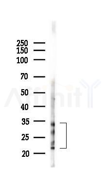 Phospho-Myelin Basic Protein/MBP (Thr232) Antibody - Western blot analysis of lysates from Hela cells(UV 30min treatment), using Phospho-Myelin Basic Protein/MBP (Thr232) Antibody at 1/1000 dilution.