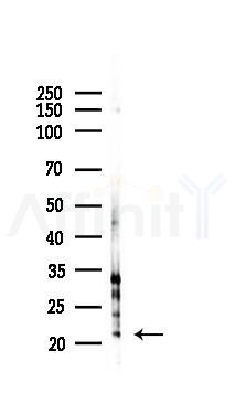 Phospho-p21 Cip1 (Ser130) Antibody - Western blot analysis of lysates from Hela cells(UV 30min treatment), using Phospho-p21 Cip1 (Ser130) Antibody at 1/1000 dilution.