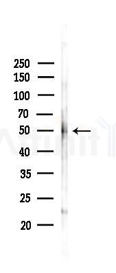 Phospho-Smad1/5/9 (Ser463+Ser465) Antibody - Western blot analysis of lysates from 293 cells(heat-shock 45min treatment), using Phospho-Smad1/5/9 (Ser463+Ser465) Antibody at 1/1000 dilution.