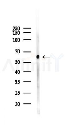 Phospho-SREBP2 (Ser455) Antibody - Western blot analysis of lysates from Mouse brain, using Phospho-SREBP2 (Ser455) Antibody at 1/1000 dilution.