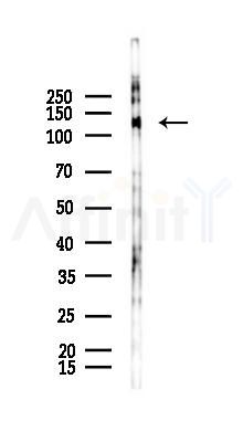 Phospho-ACK1 (Tyr857+Tyr858)[Tyr859+Tyr860] Antibody - Western blot analysis of lysates from PC12 cells(UV 30min treatment), using Phospho-ACK1 (Tyr857+Tyr858)[Tyr859+Tyr860] Antibody at 1/1000 dilution.