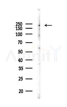 Phospho-ALK (Tyr1586) Antibody - Western blot analysis of lysates from 293 cells(heat-shock 45min treatment), using Phospho-ALK (Tyr1586) Antibody at 1/1000 dilution.