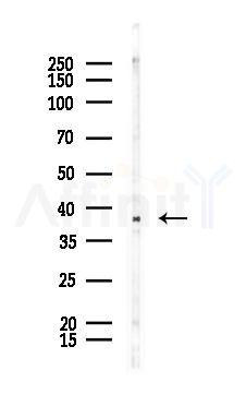 Phospho-AQP2 (Ser261) Antibody - Western blot analysis of lysates from PC12 cells(UV 30min treatment), using Phospho-AQP2 (Ser261) Antibody at 1/1000 dilution.