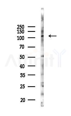 Phospho-ASAP2 (Ser701) Antibody - Western blot analysis of lysates from 293 cells(heat-shock 45min treatment), using Phospho-ASAP2 (Ser701) Antibody at 1/1000 dilution.