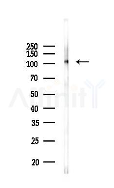 Phospho-GABBR2 (Ser884) Antibody - Western blot analysis of lysates from 293 cells(heat-shock 45min treatment), using Phospho-GABBR2 (Ser884) Antibody at 1/1000 dilution.