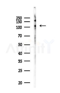 Phospho-DDR1 (Tyr796) Antibody - Western blot analysis of lysates from PC12 cells(UV 30min treatment), using Phospho-DDR1 (Tyr796) Antibody at 1/1000 dilution.