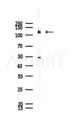 Phospho-EPHA2 (Tyr930) Antibody - Western blot analysis of lysates from HUVEC cells(UV 30min treatment), using Phospho-EPHA2 (Tyr930) Antibody at 1/1000 dilution.