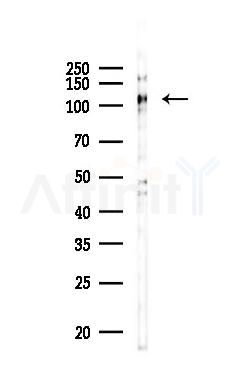 Phospho-EPHA2 (Tyr930) Antibody - Western blot analysis of lysates from PC12 cells(UV 30min treatment), using Phospho-EPHA2 (Tyr930) Antibody at 1/1000 dilution.