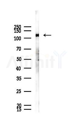 Phospho-EPHB1 (Tyr928) Antibody - Western blot analysis of lysates from HUVEC cells(UV 30min treatment), using Phospho-EPHB1 (Tyr928) Antibody at 1/1000 dilution.