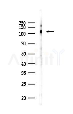 Phospho-EPHB1 (Tyr928) Antibody - Western blot analysis of lysates from PC12 cells(UV 30min treatment), using Phospho-EPHB1 (Tyr928) Antibody at 1/1000 dilution.