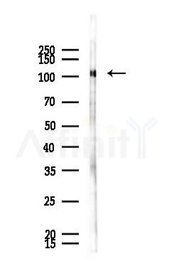 Phospho-EPHB3 (Tyr608) Antibody - Western blot analysis of lysates from HUVEC cells(UV 30min treatment), using Phospho-EPHB3 (Tyr608) Antibody at 1/1000 dilution.