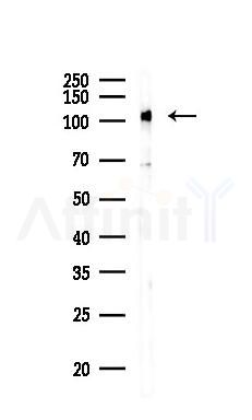 Phospho-EPHB3 (Tyr608) Antibody - Western blot analysis of lysates from PC12 cells(UV 30min treatment), using Phospho-EPHB3 (Tyr608) Antibody at 1/1000 dilution.