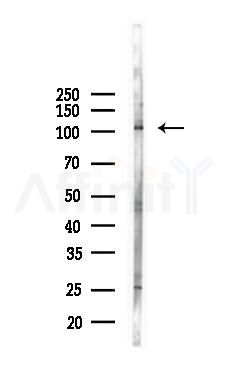 Phospho-EPHB4 (Tyr987) Antibody - Western blot analysis of lysates from 293 cells(heat-shock 45min treatment), using Phospho-EPHB4 (Tyr987) Antibody at 1/1000 dilution.