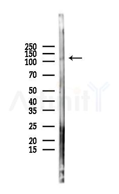 Phospho-EPHB4 (Tyr987) Antibody - Western blot analysis of lysates from K562 cells(LPS 4h treatment), using Phospho-EPHB4 (Tyr987) Antibody at 1/1000 dilution.