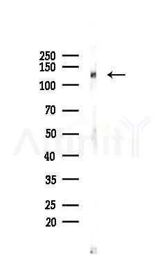 Phospho-FGFR3 (Tyr724) Antibody - Western blot analysis of lysates from HUVEC cells(UV 30min treatment), using Phospho-FGFR3 (Tyr724) Antibody at 1/1000 dilution.
